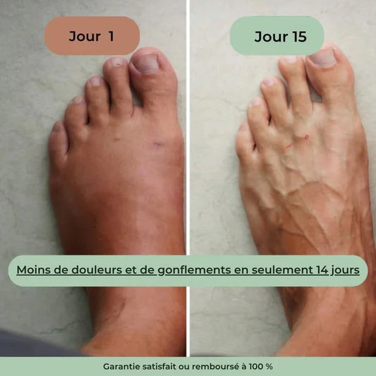 Chevillère Chauffante Thérapeutique Anti-Douleur